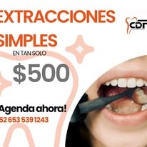 Extracciones simples Protek