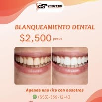 Blanqueamiento dental Protek